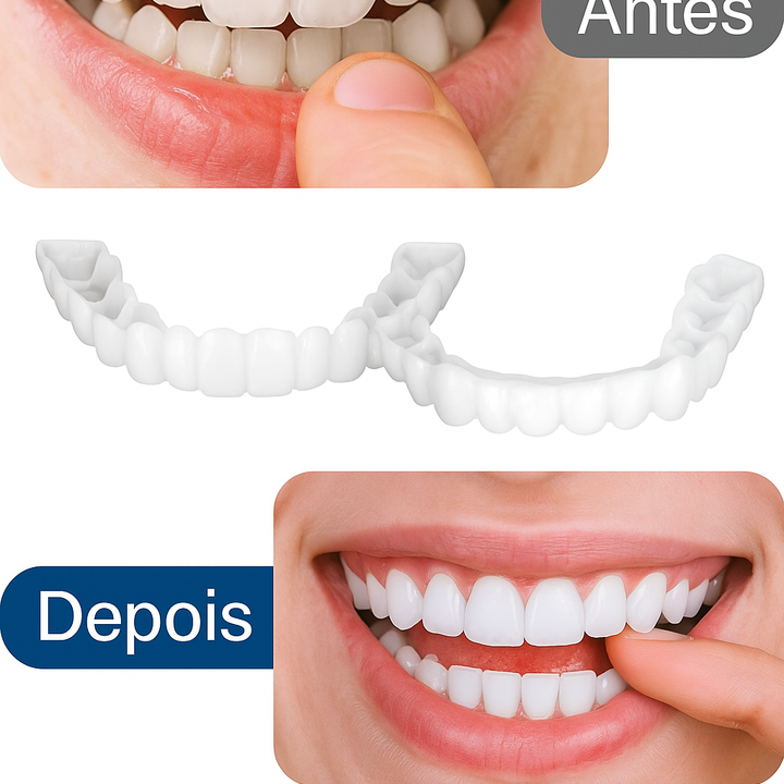 Sonrisa Radiante Express – Tu mejor versión + Envio Gratis